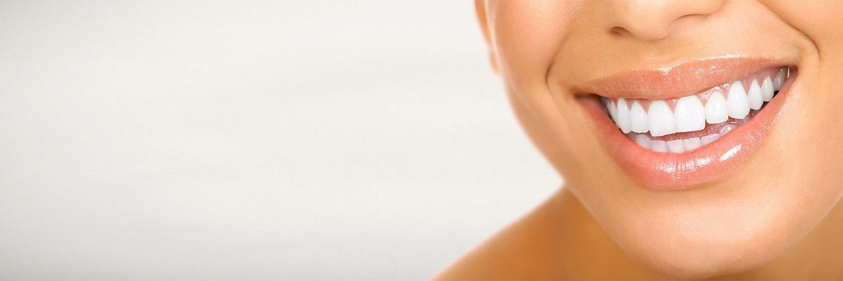 Close up of woman with veneers smiling in Flowery Branch, GA