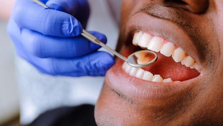 teeth check in the booker dentist